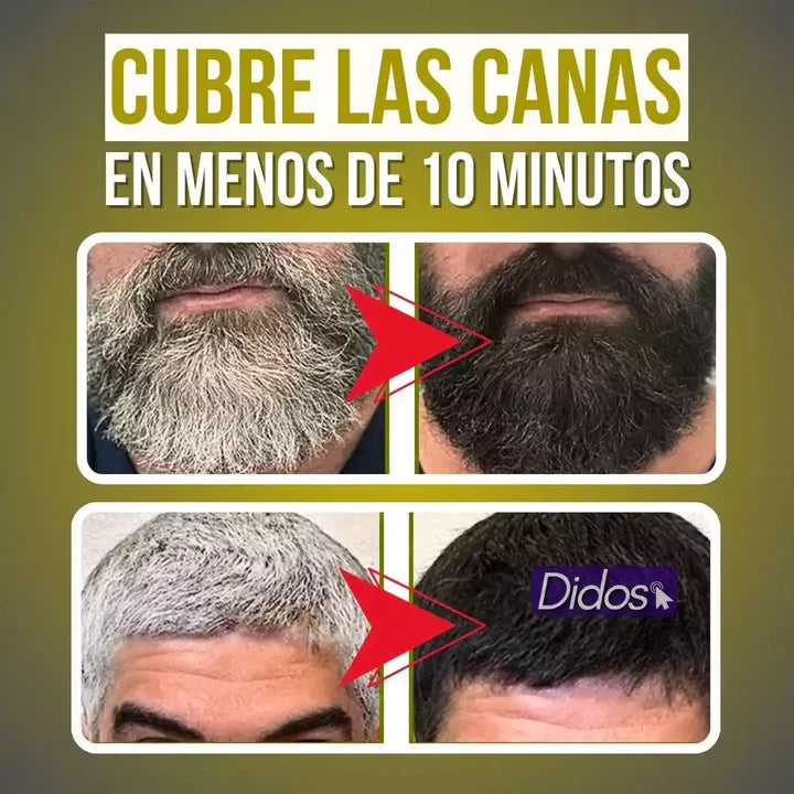 SHAMPOO ANTICANAS UNISEX BLACK PRO