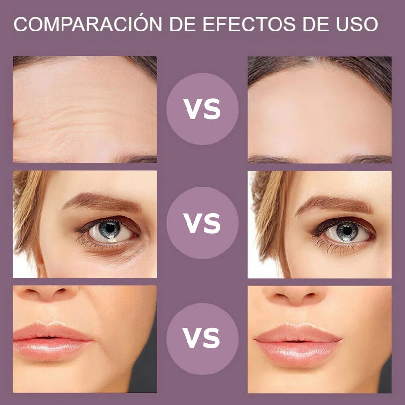 SkinGlow-Dispositivo de Rejuvenecimiento Facial con Microcorriente y Estimulación Muscular